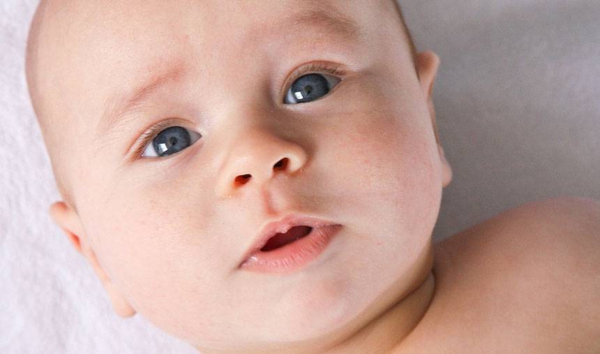 dermatite atópica em bebês